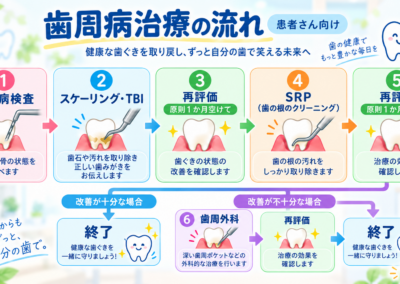 歯周病治療について