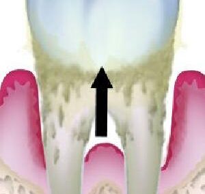 噛み合わせがおかしい