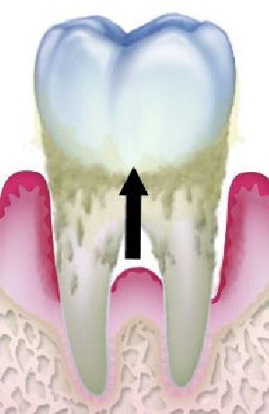 噛み合わせがおかしい