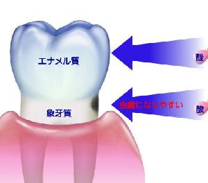 歯と歯茎の間がしみる