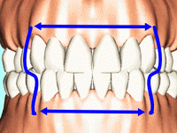 保険と自費何がちがう？